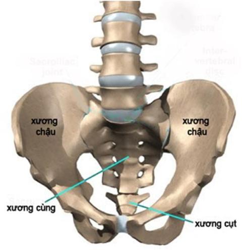 Lao xương cùng chẩn đoán thường muộn, vì sao? 