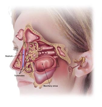 Phân biệt và điều trị bệnh viêm xoang, viêm mũi dị ứng