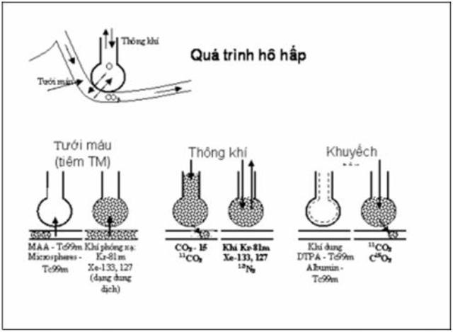 Y học hạt nhân chẩn đoán các bệnh phổi 