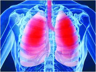 Viêm phổi và cách phòng ngừa 