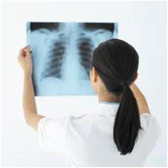 Lao màng phổi: Bệnh đứng hàng đầu trong các bệnh lao ngoài phổi