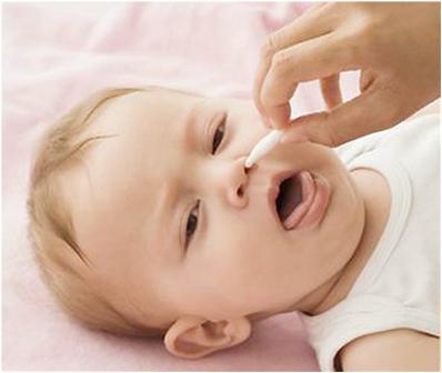 Nhiễm cúm kèm theo và kết quả điều trị viêm phổi có biến chứng ở trẻ em